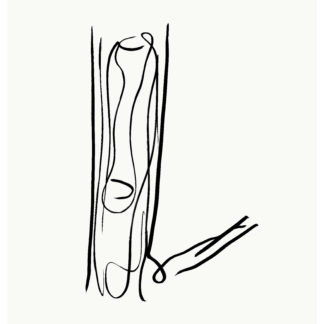 Thomas Libetti, "Arm," silkscreen on paper